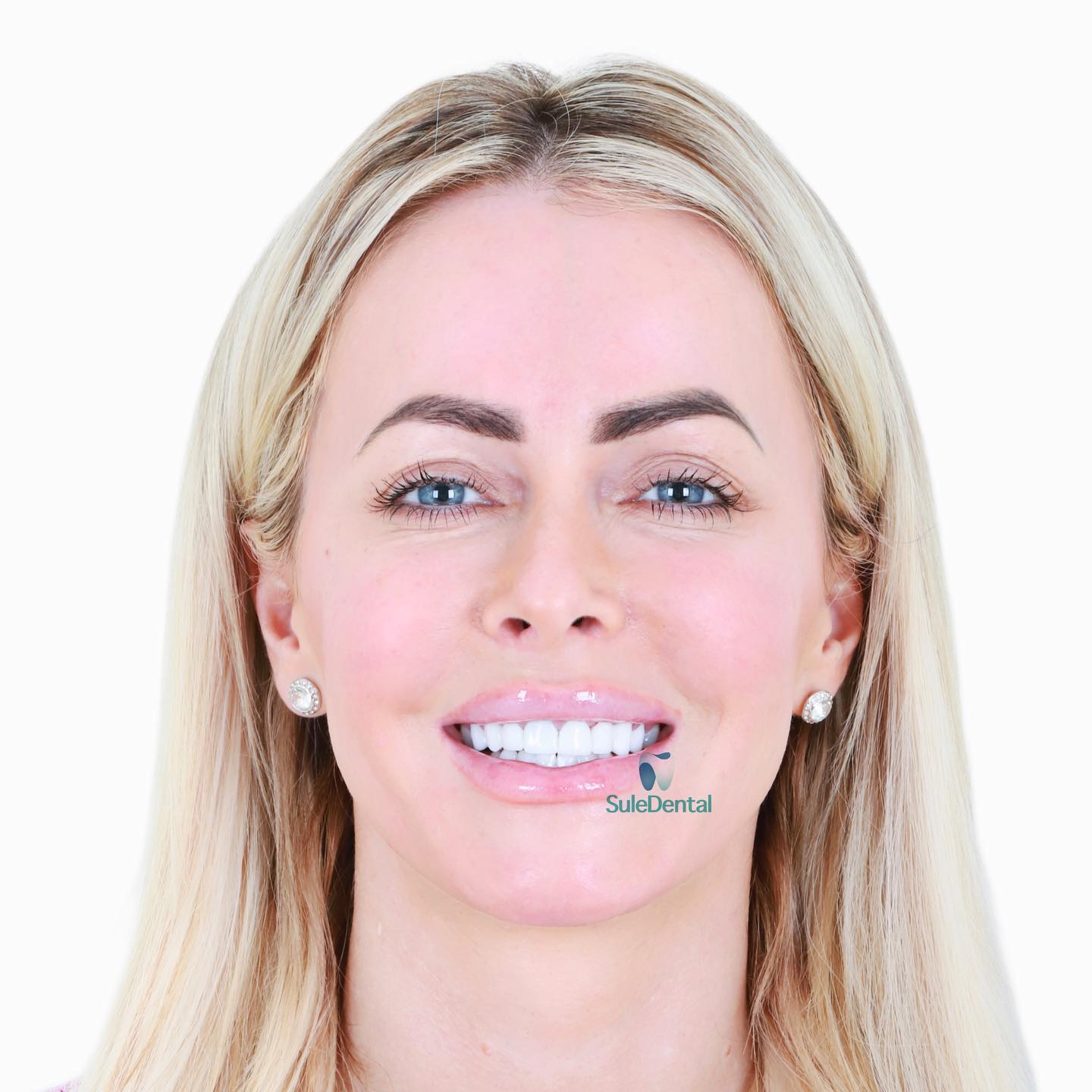 The Hollywood Smile How Sule Clinic Can Help You Get RedCarpet Ready